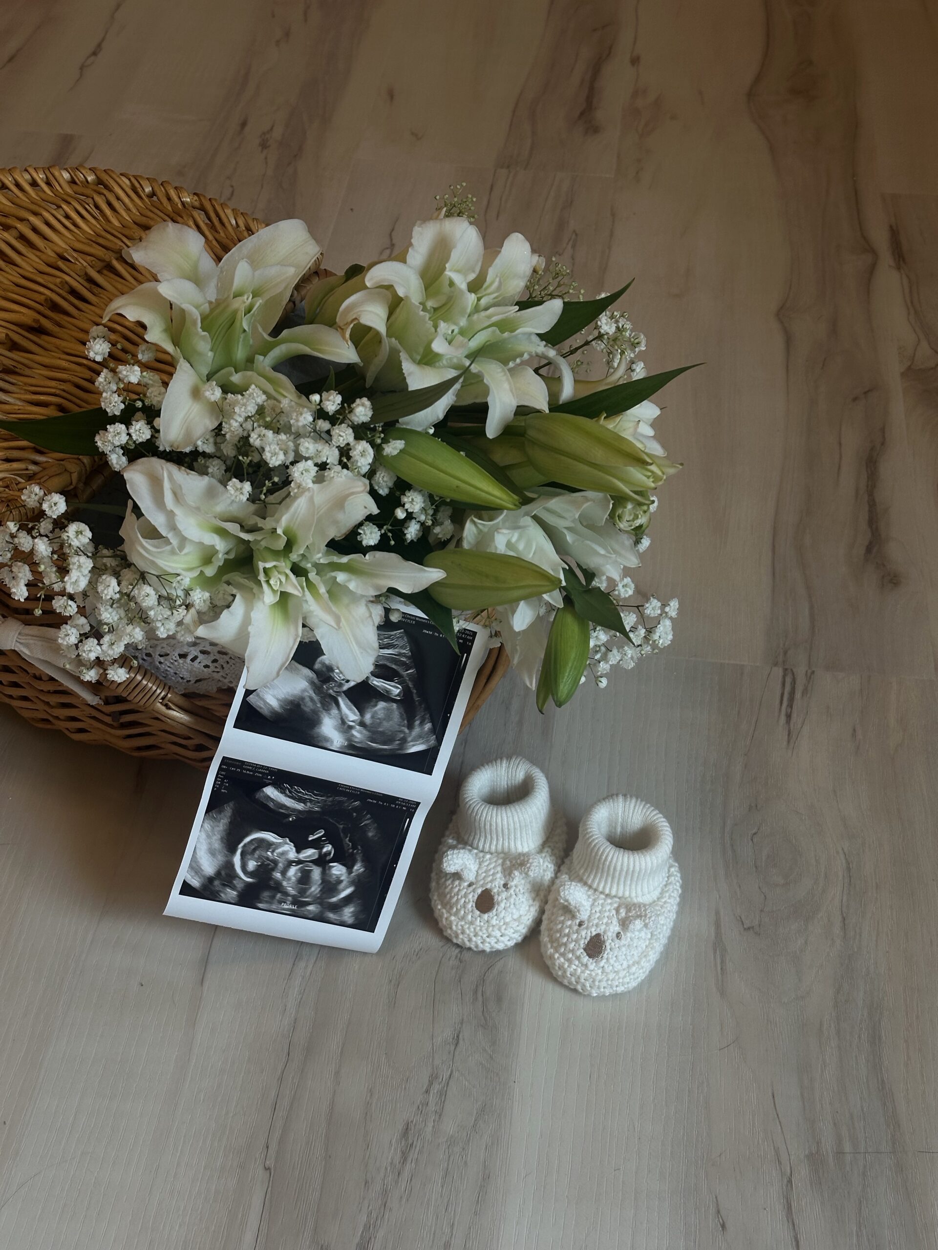 I'm Pregnant Again (First Trimester Recap & What I'm Doing Differently For Baby 2)